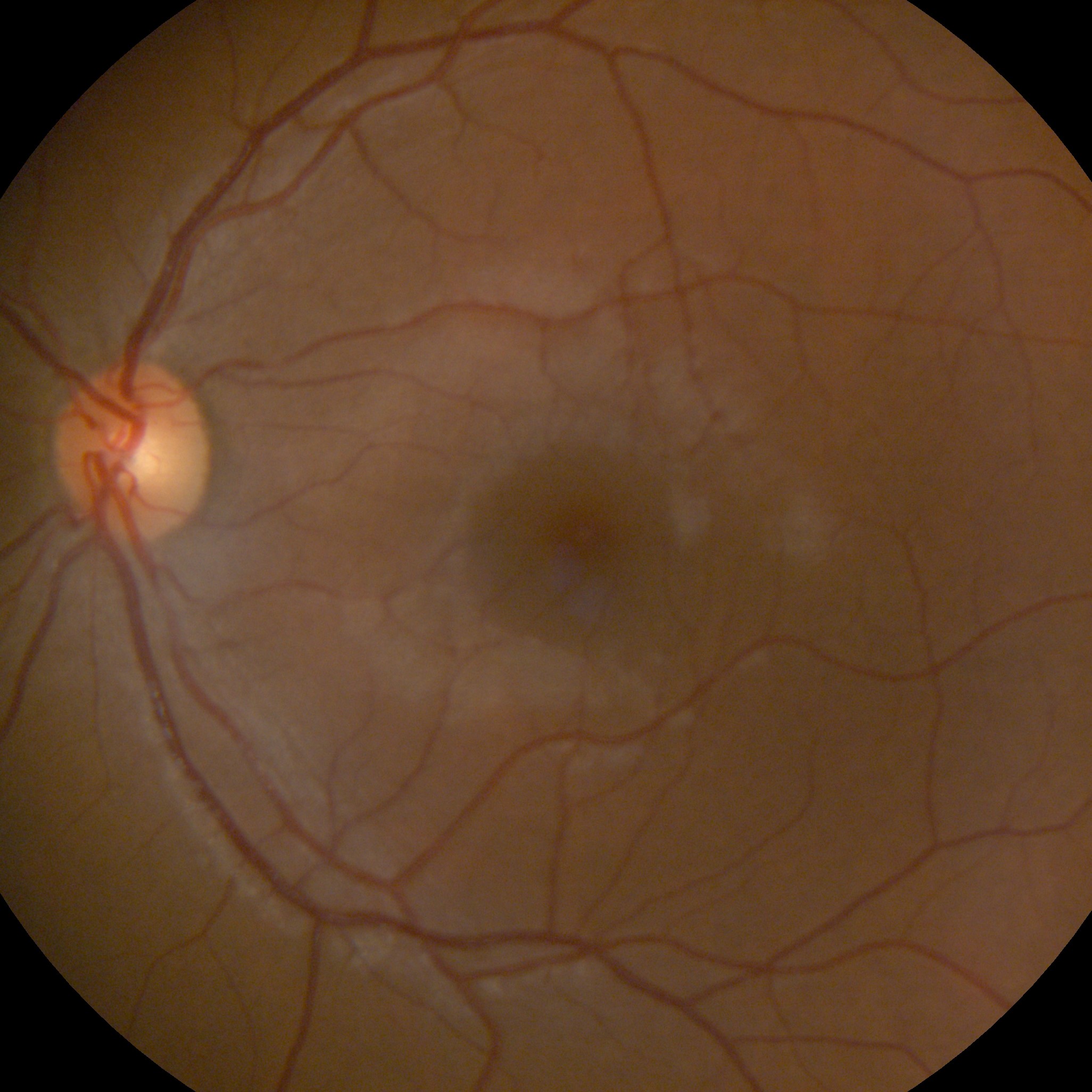 Retinografía servicios de vision